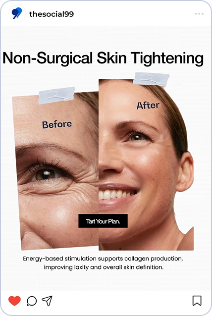 Med spa aesthetic treatment result by The Social 99
